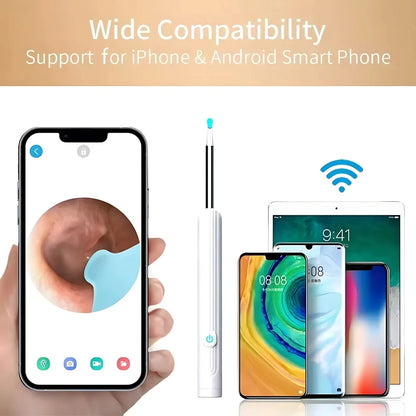 Smart Ear Cleaning Camera Otoscope